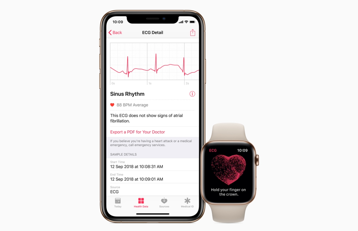 watchOS 5.2 nu beschikbaar: introduceert hartfilmfunctie in Europa